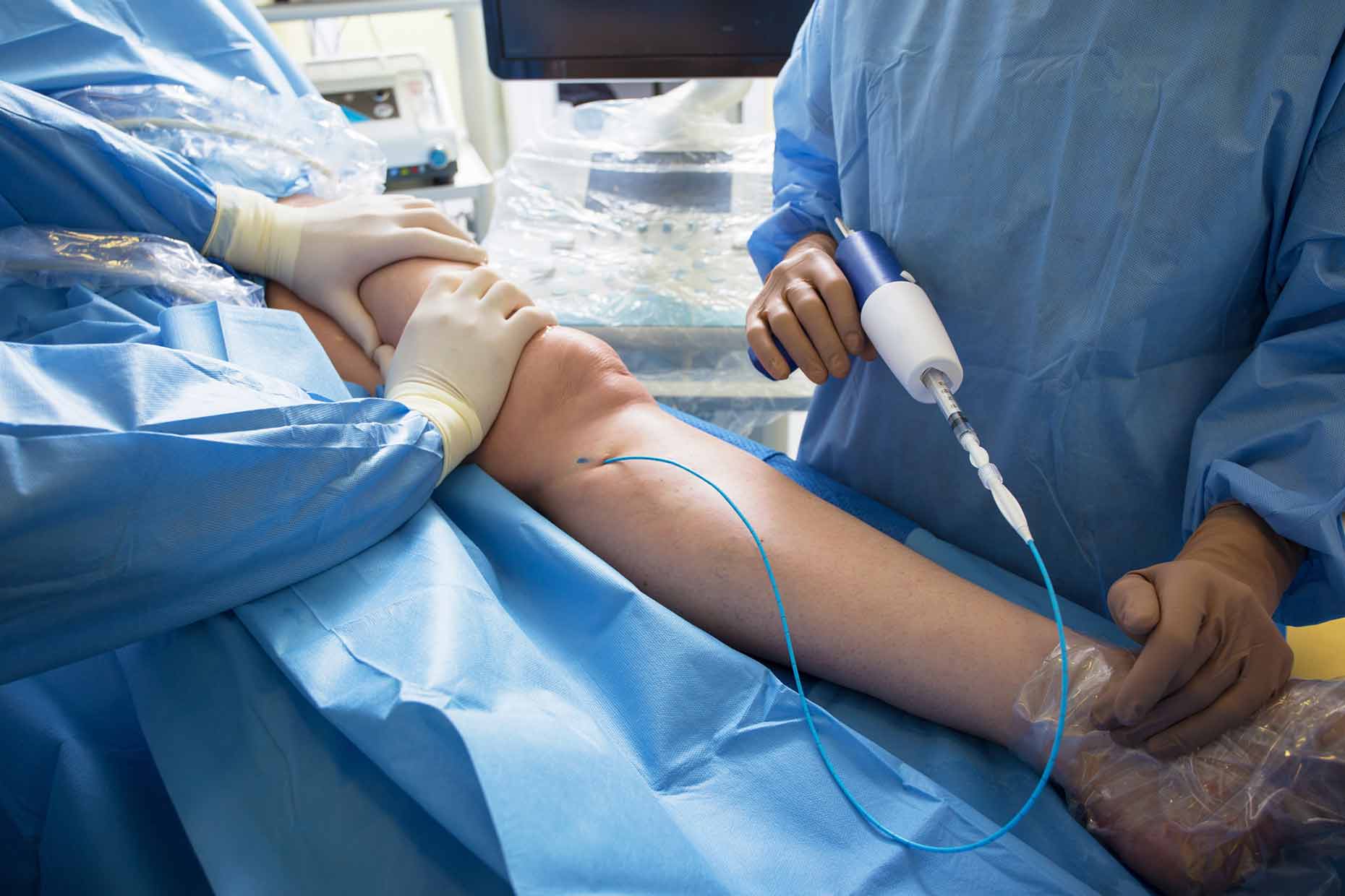 Glue Therapy medical adhesive treatment