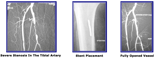 case2