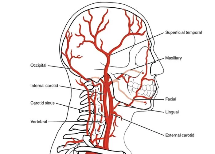 Symptoms of Artery Narrowing